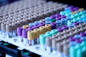 Rows of blood collection tubes with coloured caps in a laboratory rack.