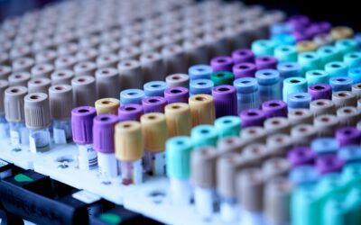 New heart attack definition adds sex-specific thresholds to tackle underdiagnosis in women